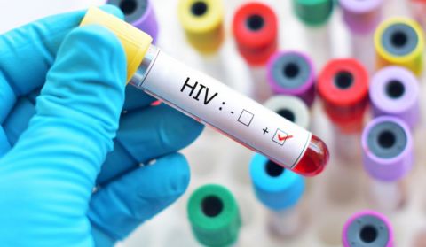 Paciente con VIH en Inglaterra se habría curado del virus