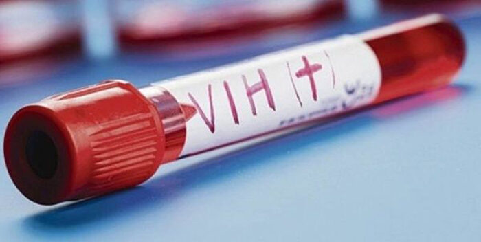 América Latina ante el reto de tumbar el mito de vacunas en pacientes con VIH