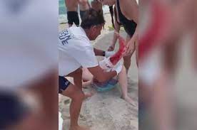 Hombre muere luego de ser atacado por un tiburón