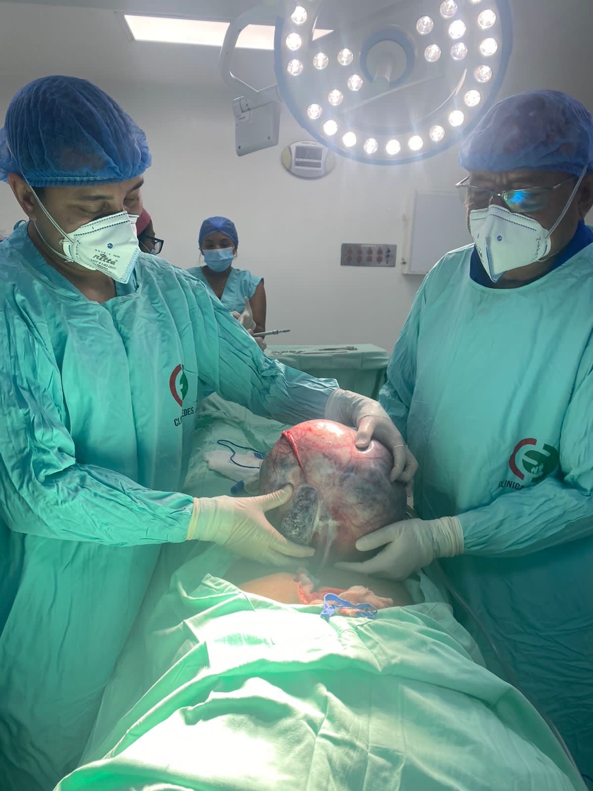 Le extraen un tumor de más seis kilos en clínica Cedes de Riohacha