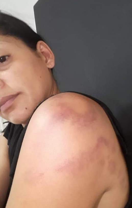Militar golpeó a su mujer en Valledupar