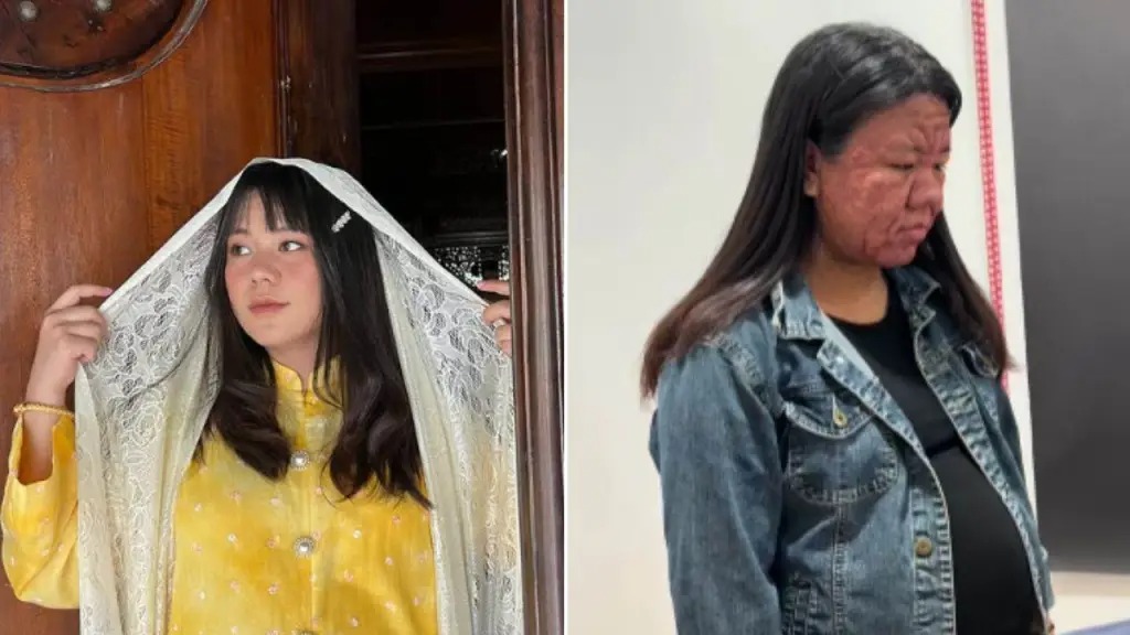 El embarazo transformó su rostro y su historia se volvió viral en redes: “Mi cara cambió al 100%”